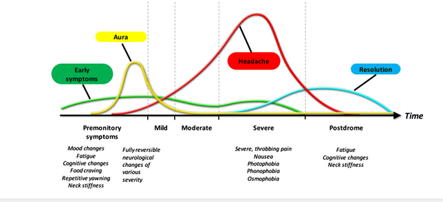 Image for migraine postdrome treatment with ID of: 3792878