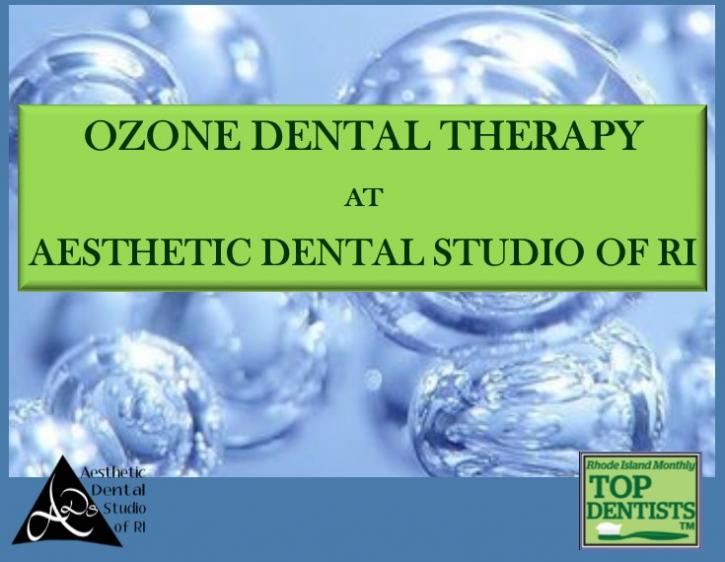 Image for Ozone Dental Therapy with ID of: 3793997