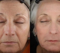 Image for Bay Dermatology & Cosmetic Surgery with ID of: 3803781