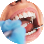 Image for Biocompatible Porcelain Implants Safely Replace Teeth in Greenville with ID of: 3821613