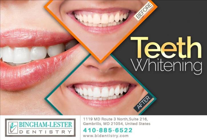 Image for Teeth Whitening Gambrills with ID of: 3860091