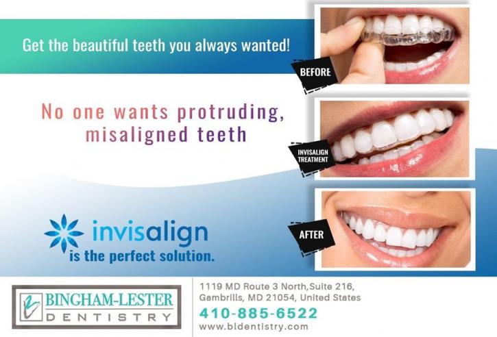 Image for Invisalign Braces Benefits near Crofton MD with ID of: 3860497