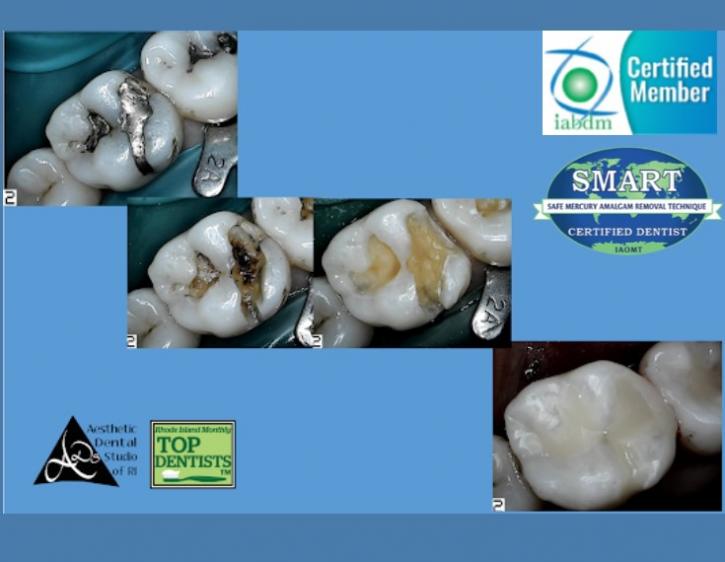 Image for Ozone Dental Therapy with ID of: 3863302
