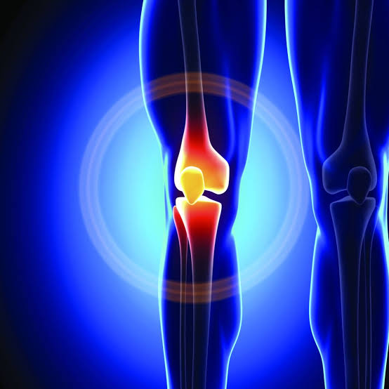 Image for Diet Tips For Post Knee Surgery with ID of: 3872693
