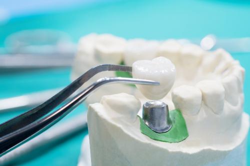 Image for Alton Implant Center & Dentistry with ID of: 3889423