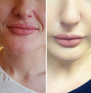 Image for Aesthetics by Dr Brown with ID of: 3895248