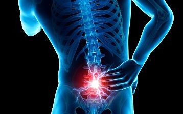 Image for Visit Us For Your Back pain relief in Glendale! with ID of: 3913589