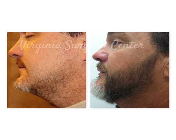 Image for Virginia Surgical Center with ID of: 3916895
