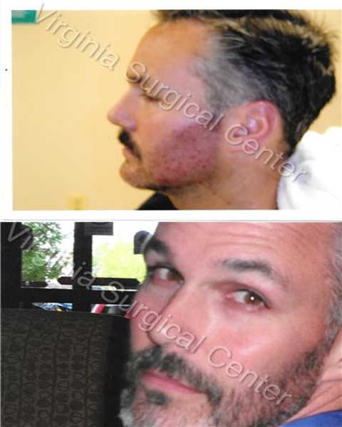 Image for Virginia Surgical Center with ID of: 3917002