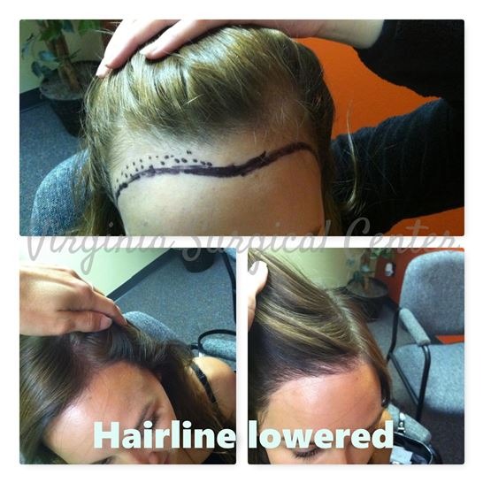 Image for Virginia Surgical Center with ID of: 3917004