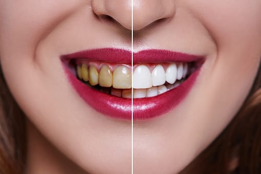 Image for Get Quality Dental Care In Plainfield, IL with ID of: 3919312