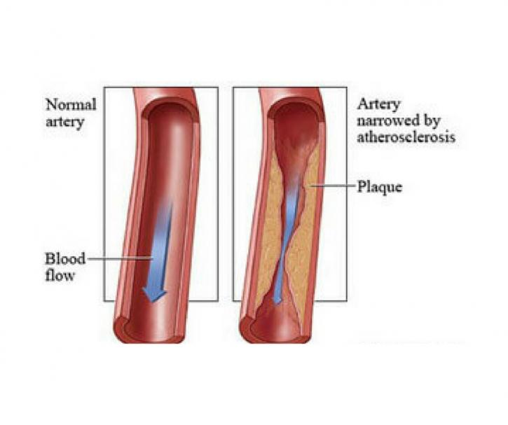 Image for USA Vascular Centers with ID of: 3929570