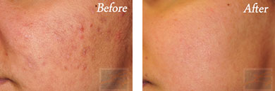 Image for Cooltouch Laser New Orleans with ID of: 3933680