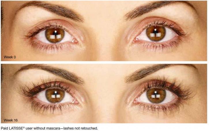 Image for North Metro Dermatology with ID of: 3977039