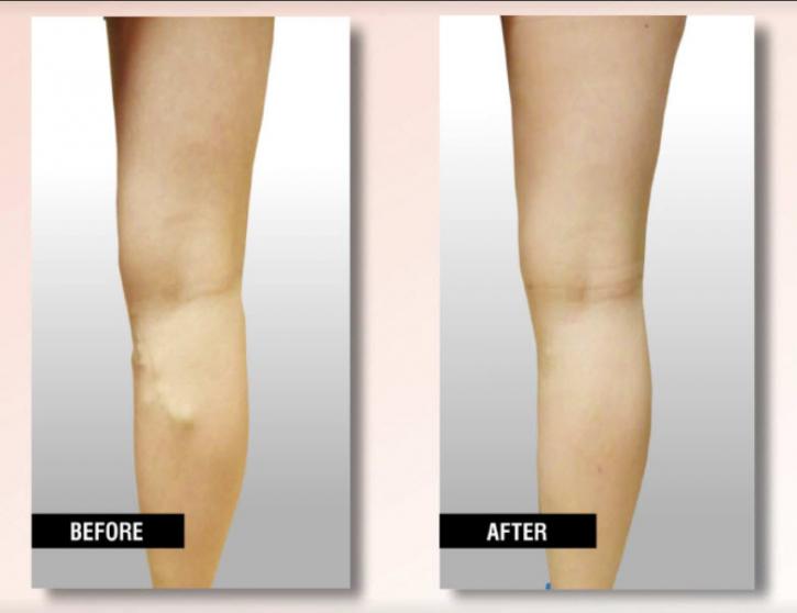 Image for USA Vein Clinics with ID of: 3985121