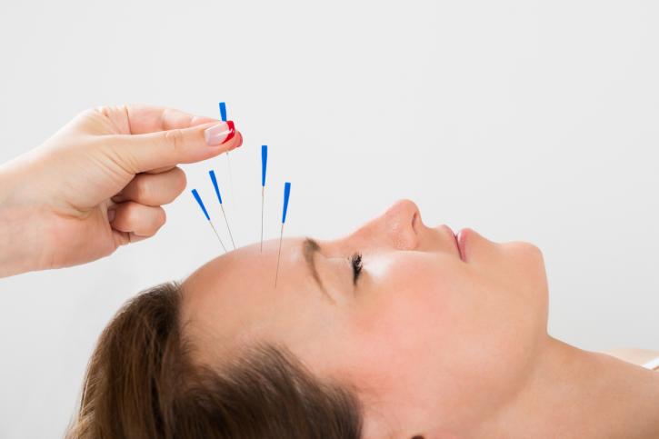 Image for Parry Sound Acupuncture with ID of: 3988232