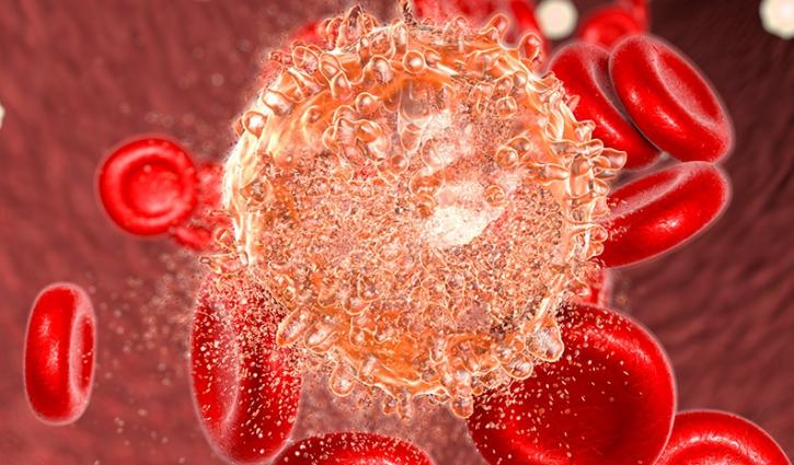Image for Hematologic Malignancies Market Size Worth $85.8 Billion By 2025 with ID of: 3996152
