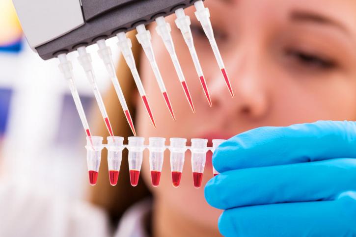 Image for Cell Line Development Market To Reach $6.24 Billion By 2022 with ID of: 4001934