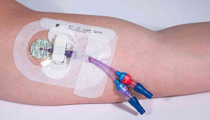 Image for Catheter Stabilization Devices Market Size Worth $1.83 Billion By 2025 with ID of: 4004485