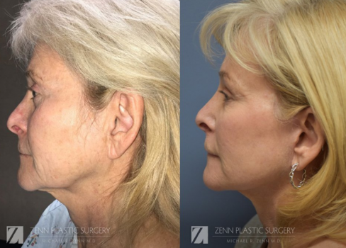 Image for Zenn Plastic Surgery with ID of: 4030491