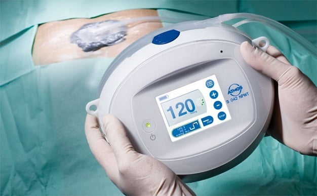 Image for Negative Pressure Wound Therapy Market Size Worth $4.0 Billion By 2025 with ID of: 4031027