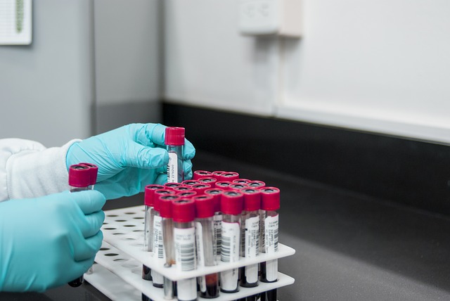 Image for Global Vitamin D Testing Market Size, Share, Growth, Trend and Industry Analysis Report, 2018 to 2025 with ID of: 4042422