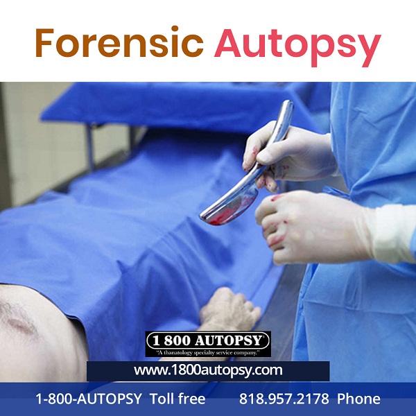 Image for Forensic Autopsy with ID of: 4062580