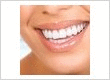 Image for Dental Veneers & Lumineers with ID of: 4067254