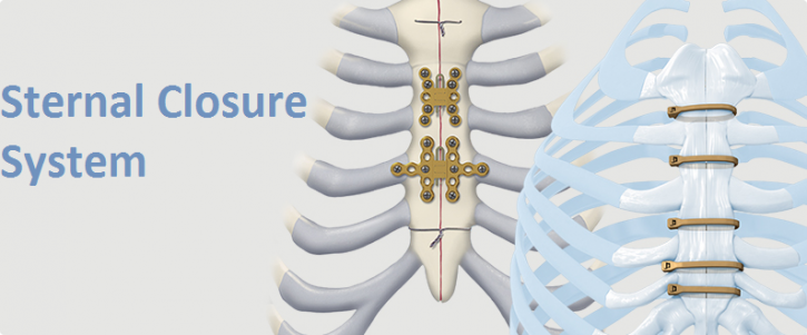 Image for Sternal Closure Systems Market Size Worth $3.12 Billion By 2026 with ID of: 4073779