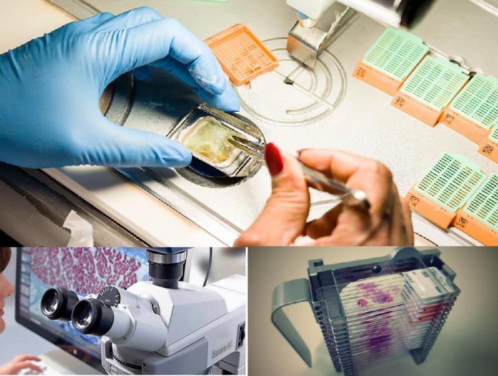 Image for Anatomic Pathology Market Worth $23.3 Billion By 2025 with ID of: 4077580