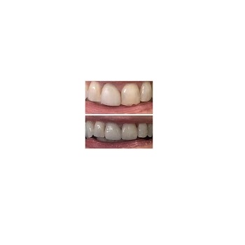 Image for Dover Dental with ID of: 4081352