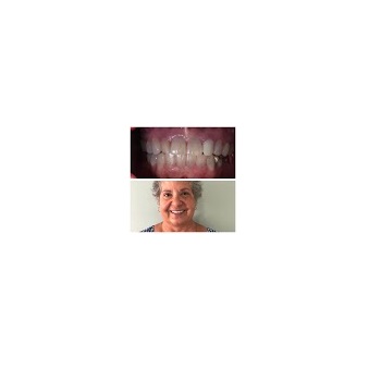 Image for Dover Dental with ID of: 4081353