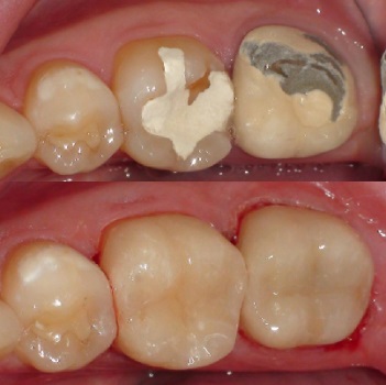 Image for Seminole Dentistry with ID of: 4088689