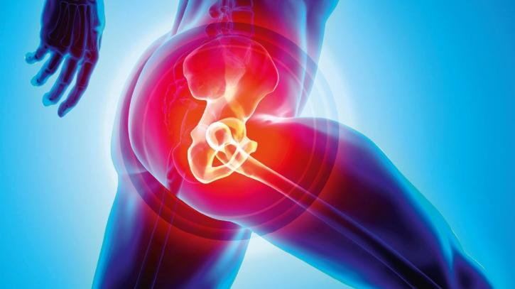 Image for Hip Replacement Implants Market Size Worth $7.8 Billion By 2026 with ID of: 4091770