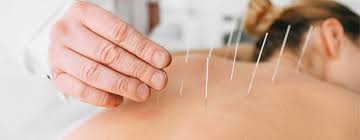 Image for Shona Campbell Acupuncture with ID of: 4113607