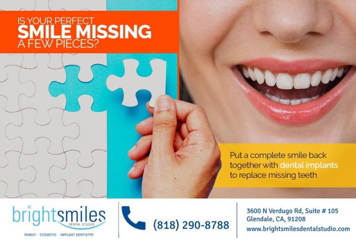 Image for Tooth Implant Surgery in CA with ID of: 4121684