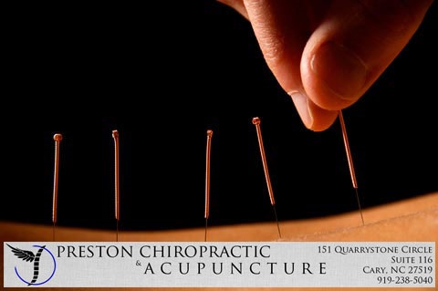 Image for Preston Chiropractic and Acupuncture with ID of: 4126950