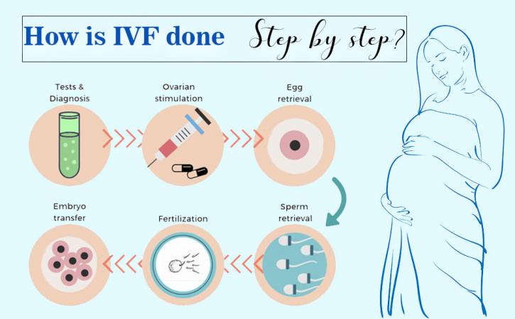 Image for Infertile Couples - IVF Treatment - Step by Step Process with ID of: 4130045