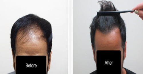 Image for AZ Hair Restoration with ID of: 4179502