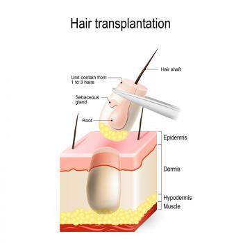 Image for AZ Hair Restoration with ID of: 4179511