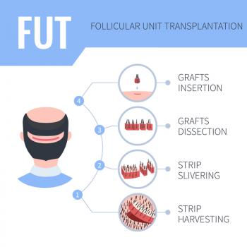 Image for AZ Hair Restoration with ID of: 4179515
