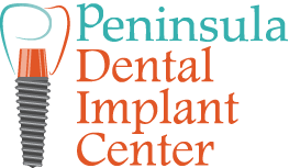 Image for Affordable dental implants with ID of: 4181118