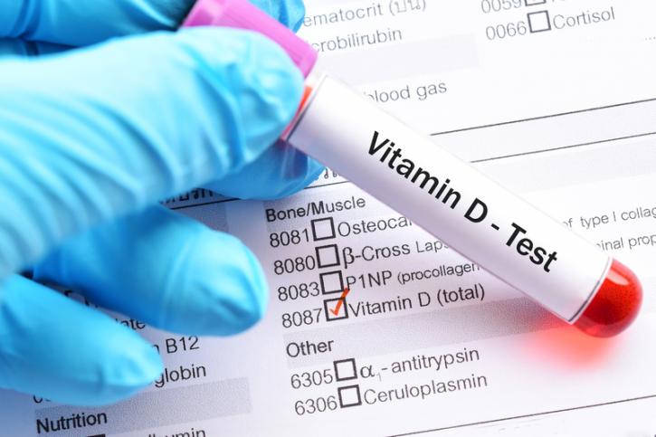 Image for Global Vitamin D Testing Market 2020 | Manufacturers Regions Type And Application Forecast To 2025 with ID of: 4189532