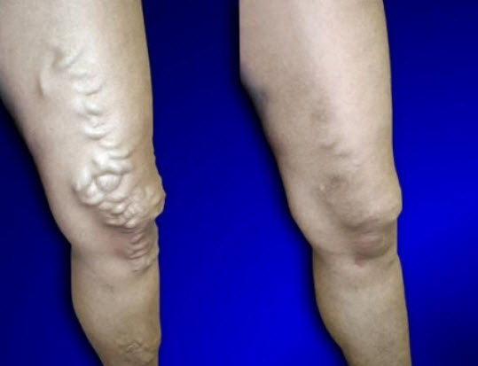 Image for USA Vein Clinics with ID of: 4213256