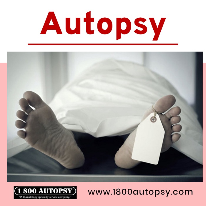 Image for Autopsy with ID of: 4229304