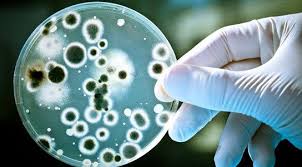 Image for mycotoxin testing kits with ID of: 4241386
