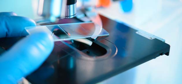 Image for Global Infectious Disease Diagnostics Testing Market 2020 | Manufacturers, Regions, Type And Application, Forecast To 2025 with ID of: 4269626