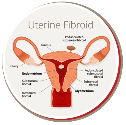 Image for USA Fibroid Centers with ID of: 4270146