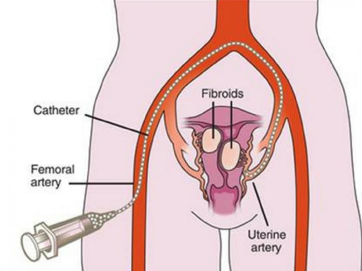 Image for USA Fibroid Centers with ID of: 4270147