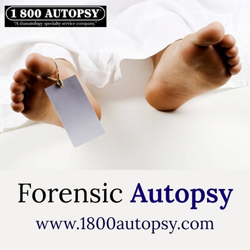 Image for Forensic Autopsy with ID of: 4281748